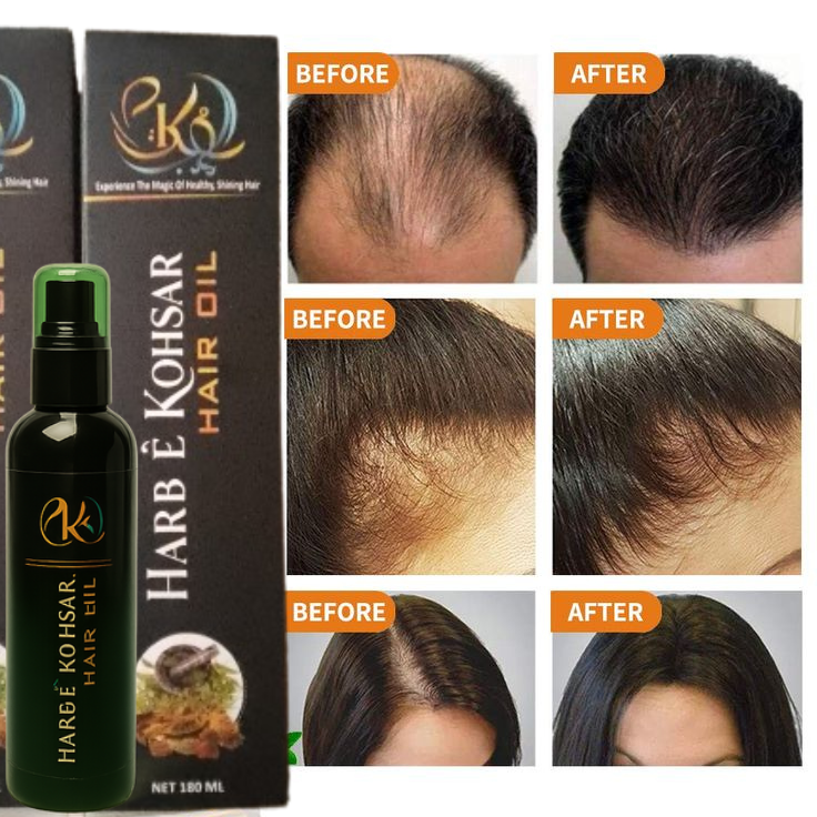 Harb-E-Kohsar Hair Oil Remove Dandruffs Stop Hair Fall